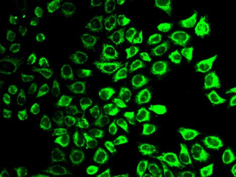 Polyclonal Rabbit anti-Human CASP7 / Caspase 7 Antibody (IHC, IF, WB)