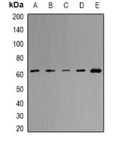 Polyclonal Rabbit anti-Human MCCC2 / MCCB Antibody (IHC, WB)