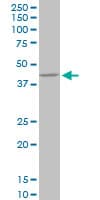 PPP1R8 / Rnase E Antibody (clone 1G11)