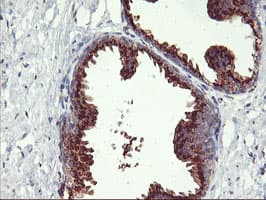 GOLM1 / GP73 / GOLPH2 Antibody (clone OTI2D6)