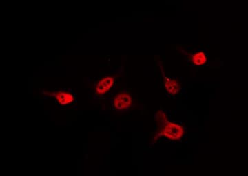 API5 Antibody