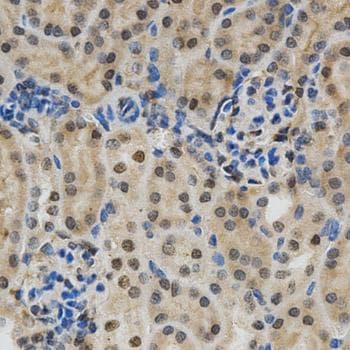 LGALS3 / Galectin 3 Antibody