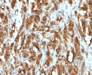Monoclonal Mouse anti-Human Actin Antibody (clone HHF35, Azide-free,BSA-free, IHC, IF, WB)