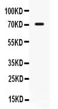 Polyclonal Rabbit anti-Human IL7R / CD127 Antibody (WB)