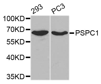 Polyclonal Rabbit anti-Human PSPC1 Antibody (WB)