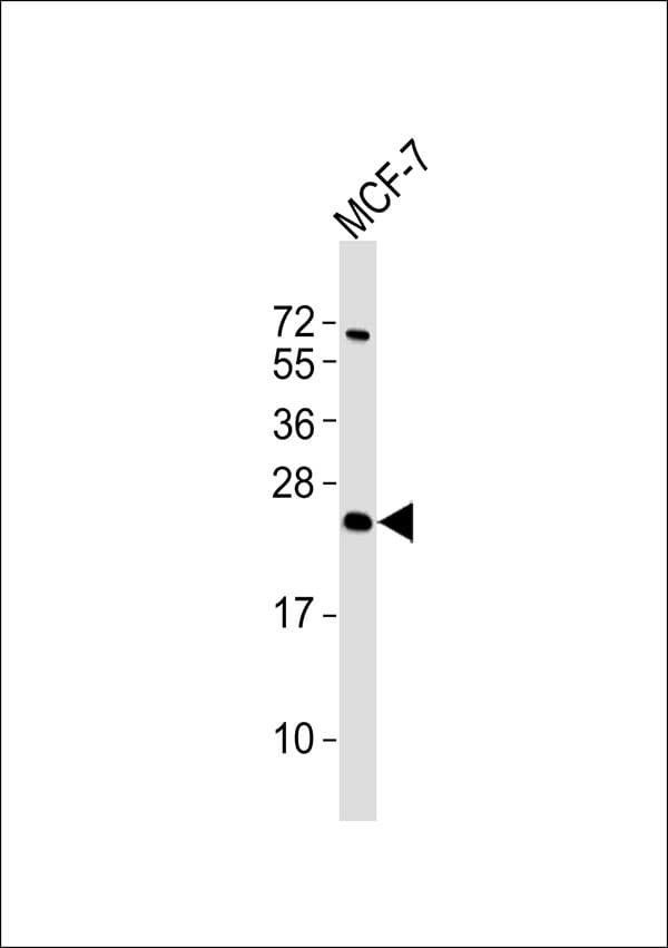 Polyclonal Rabbit anti-Human ATP5S Antibody (WB)
