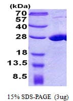 Human COMMD7 Protein (Recombinant His)