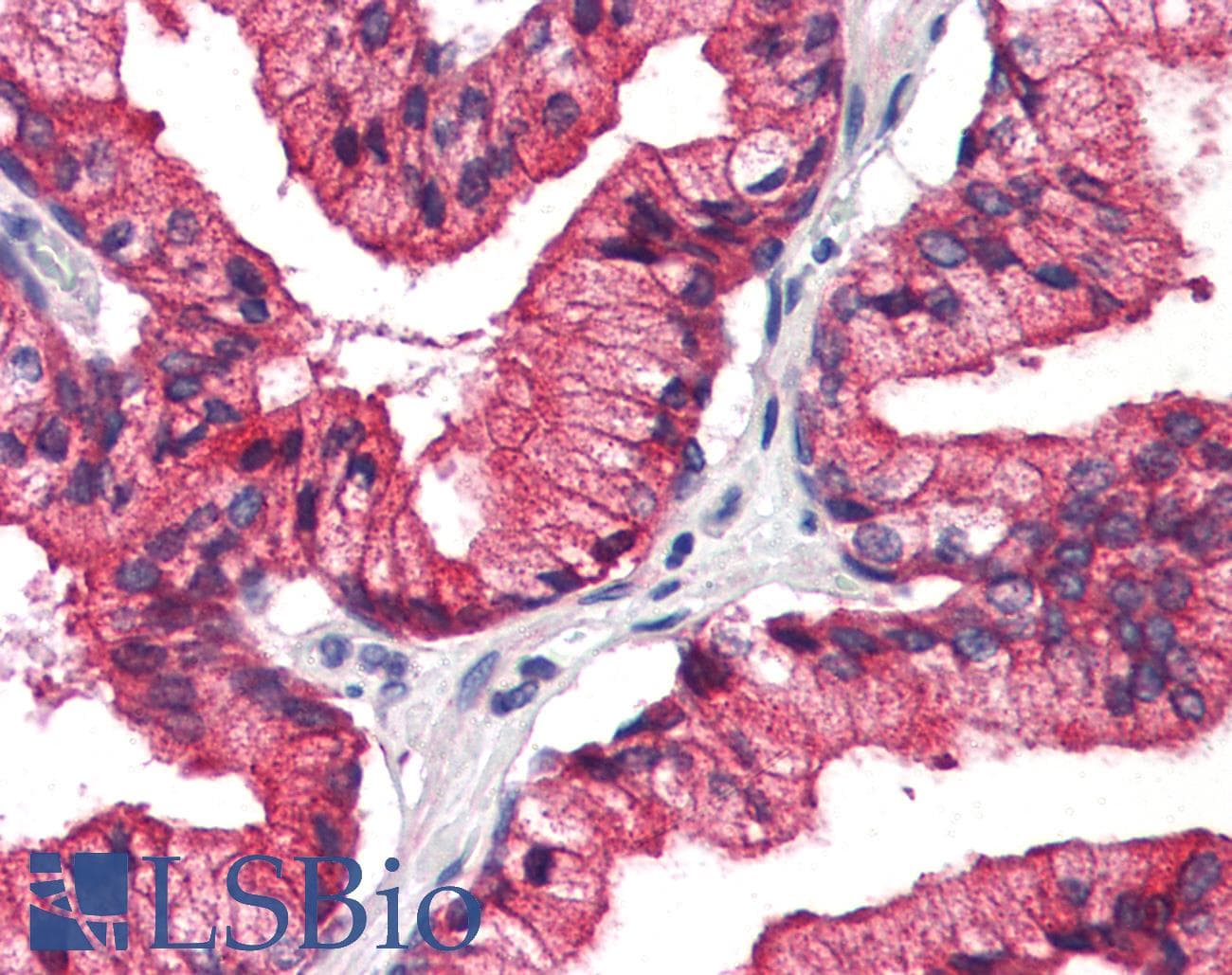 IHC-plus™ REEP5 Antibody (C-Terminus)