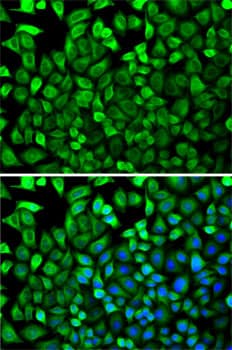 CDA / Cytidine Deaminase Antibody