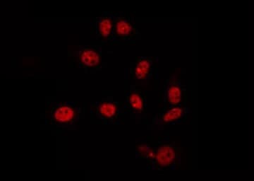 Polyclonal Rabbit anti-Human HEXIM1 Antibody (IF, WB)