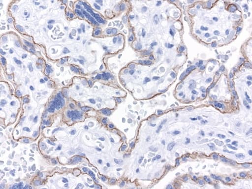 CDH1 / E Cadherin Antibody (clone UMAB184)