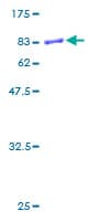 Human KIN17 / KIN Protein (Recombinant GST)