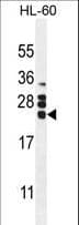 CSF2 / GM-CSF Antibody (aa59-85)