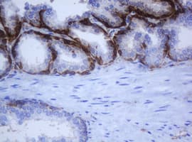 KRT5 / CK5 / Cytokeratin 5 Antibody (clone OTI6F8)