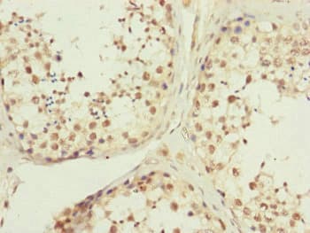 Polyclonal Rabbit anti-Human KIAA0391 Antibody (IHC, WB)