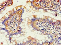 AKR1B10 Antibody (aa1-316)