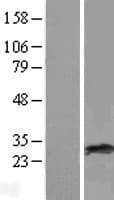 RAB38 Protein (Over-Expression Lysate Myc-DDK (Flag))