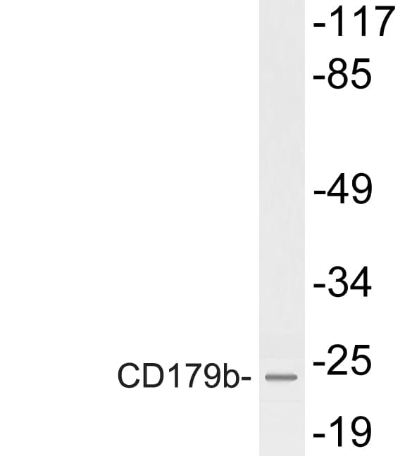 Polyclonal Rabbit anti-Human IGLL1 / CD179b Antibody (aa26-75, WB)