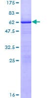 Human ZMAT3 Protein (Recombinant GST)