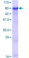 Human ZIM2 Protein (Recombinant GST)