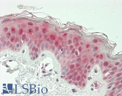 IHC-plus™ SERPINB7 / MEGSIN Antibody (Internal)