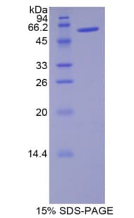 Rat NOG / Noggin Protein (Recombinant His-MBP)
