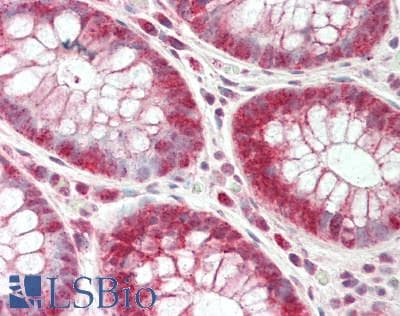CLPTM1L / CLPTM1-Like Antibody (aa467-516)