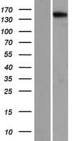 PNPLA6 / NTE Protein (Over-Expression Lysate Myc-DDK (Flag))