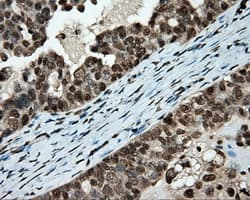 Monoclonal Mouse anti-Human APP / Beta Amyloid Precursor Antibody (clone OTI9E2, IHC, IF, WB)