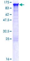 Human ACTN4 Protein (Recombinant GST)