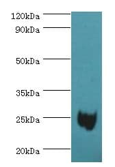 MAD2L1 / MAD2 Antibody (aa1-205)