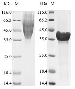 Aggregatibacter actinomycetemcomitans lktA Protein (Recombinant 6His, N-terminus)