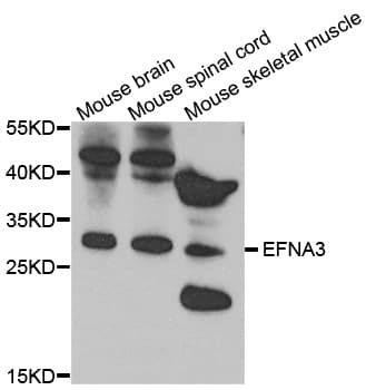 EFNA3 / Ephrin A3 Antibody