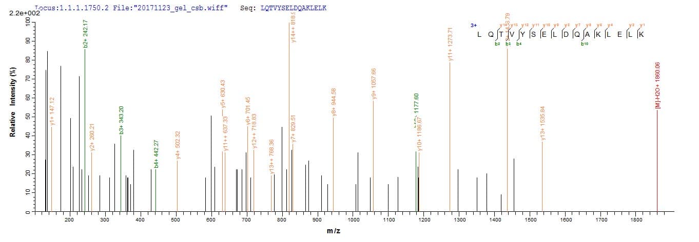 Human TRAIP / TRIP Protein (Recombinant 10His, N-terminus)