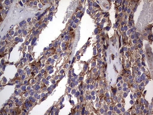 Monoclonal Mouse anti-Human CD63 Antibody (clone OTI5E5, IHC, WB)