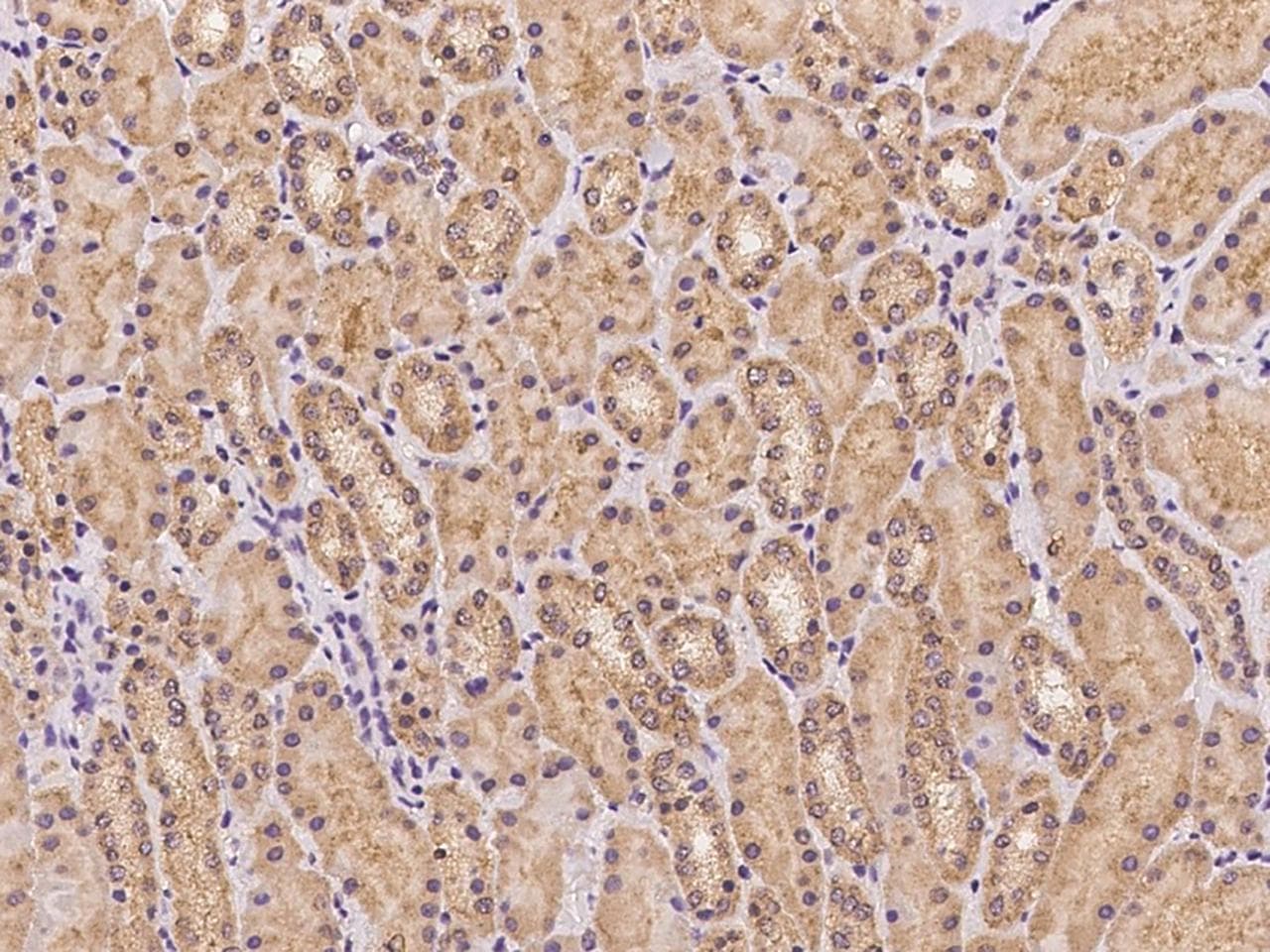 Polyclonal Rabbit anti-Human FAM83F Antibody (IHC)