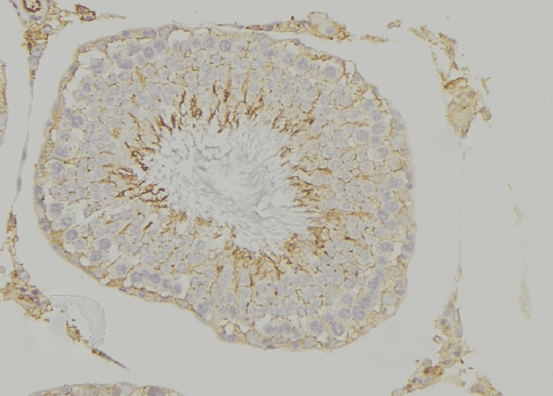 Polyclonal Rabbit anti-Human HMOX1 / HO-1 Antibody (IHC, WB)