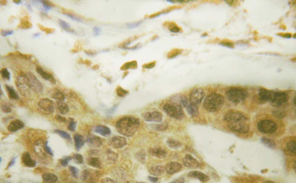 Polyclonal Rabbit anti-Human RPS6KA5 / MSK1 Antibody (phospho-Ser212, IHC, WB)