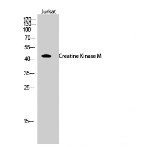 CKM / Creatine Kinase MM Antibody (10-90 aa, N-terminal)