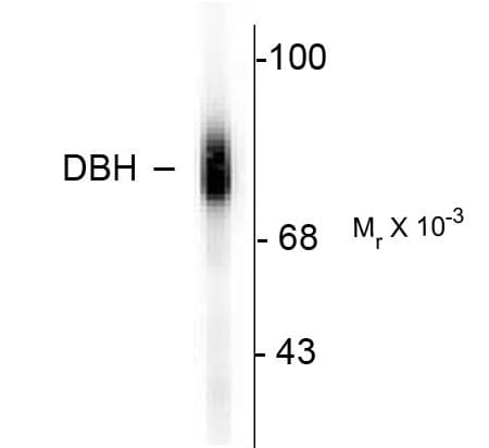IHC-plus™ DBH/Dopamine Beta Hydroxylase Antibody (C-Terminus)