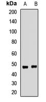 SEPT4 / Septin 4 Antibody