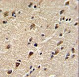DDX5 Antibody (aa306-334)
