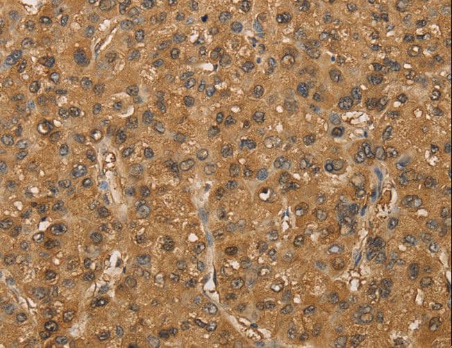 SETD2 Antibody