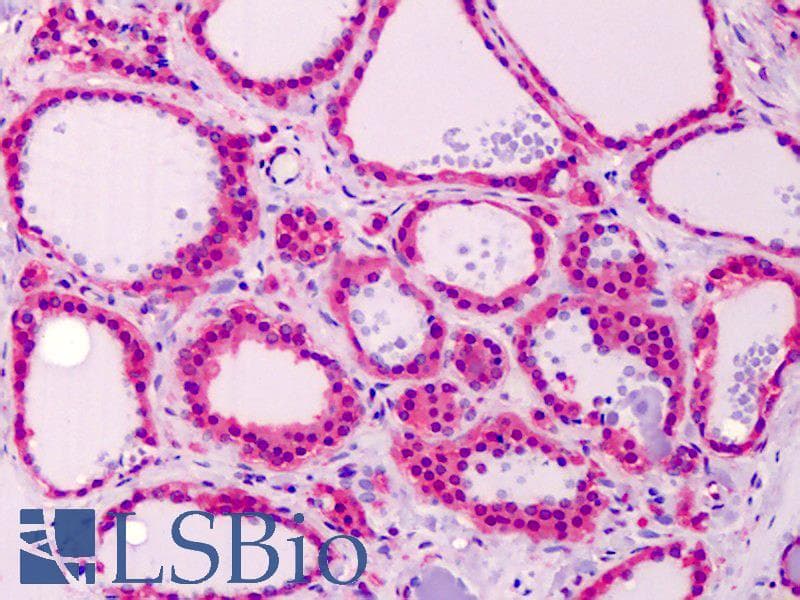 IHC-plus™ Calmodulin Antibody (C-Terminus)