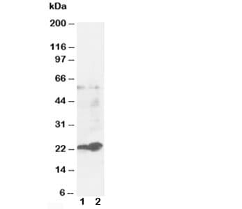 GSTP1 / GST Pi Antibody (aa197-210)