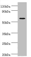 Polyclonal Rabbit anti-Human CRY2 Antibody (aa434-593, IHC, WB)