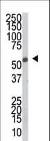 SRPK2 Antibody (aa465-495)