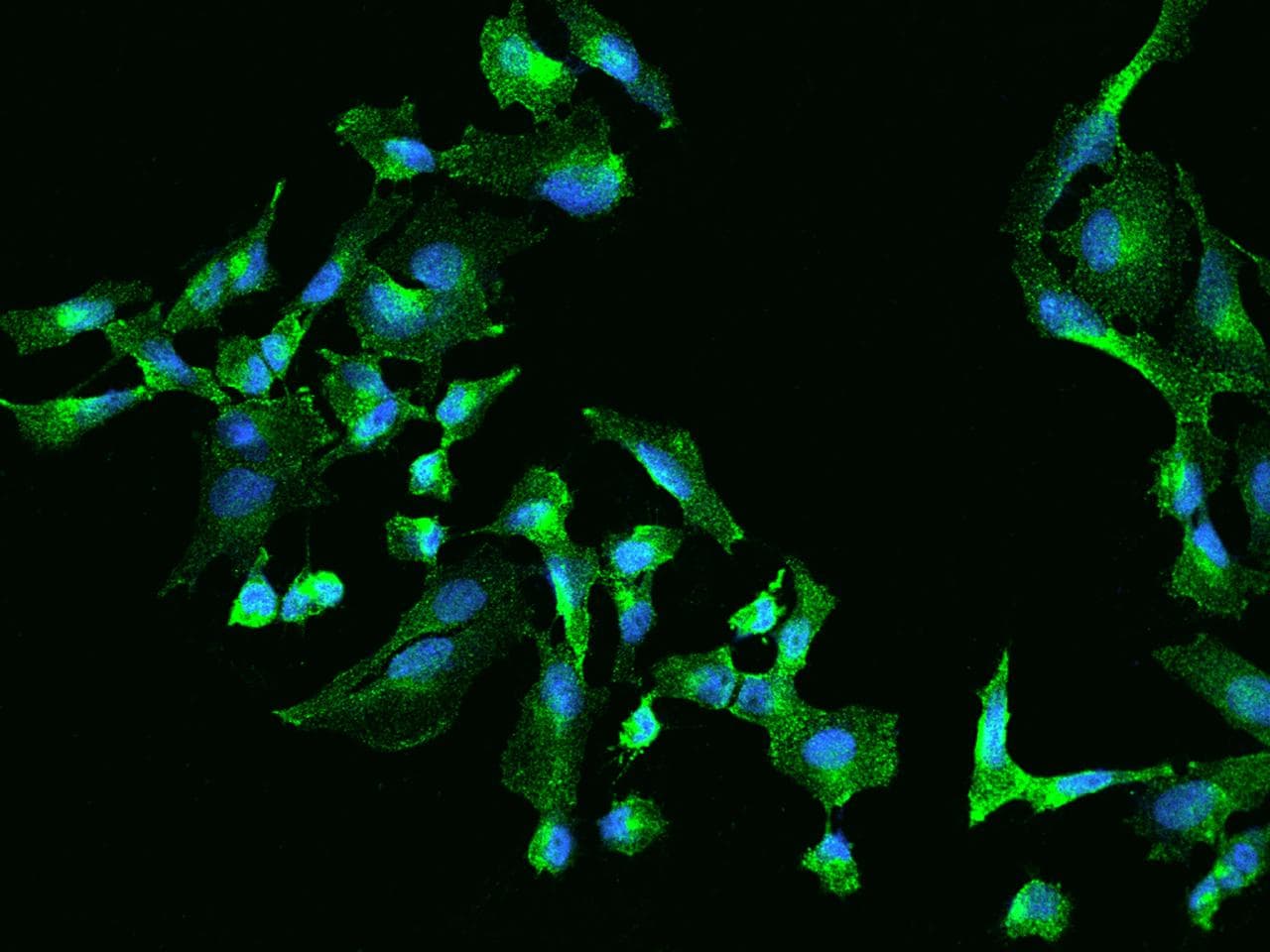 CLTA / LCA Antibody