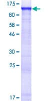 Human AMPD2 Protein (Recombinant GST)