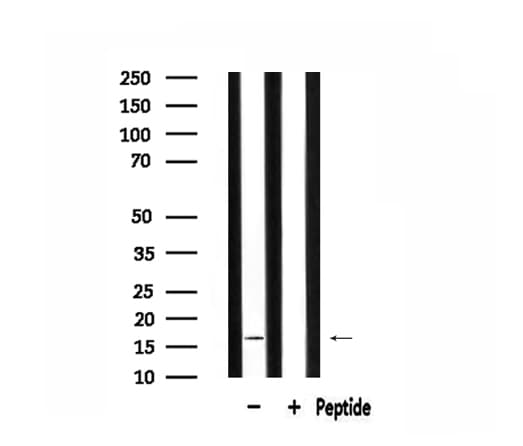 MRPL14 Antibody